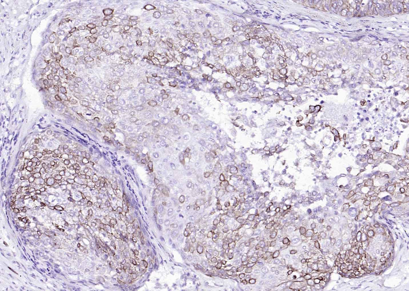 Mouse anti-Cytokeratin 8 Monoclonal Antibody