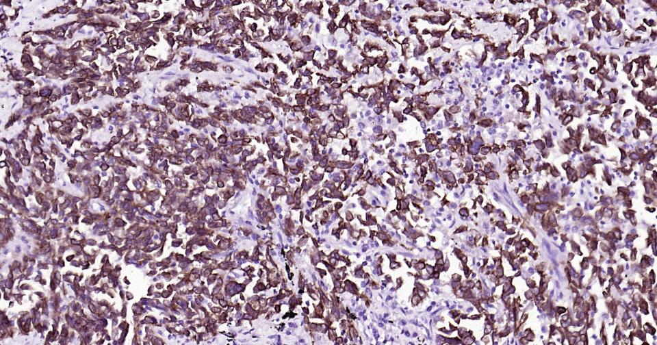 Mouse anti-Cytokeratin 19 Monoclonal Antibody