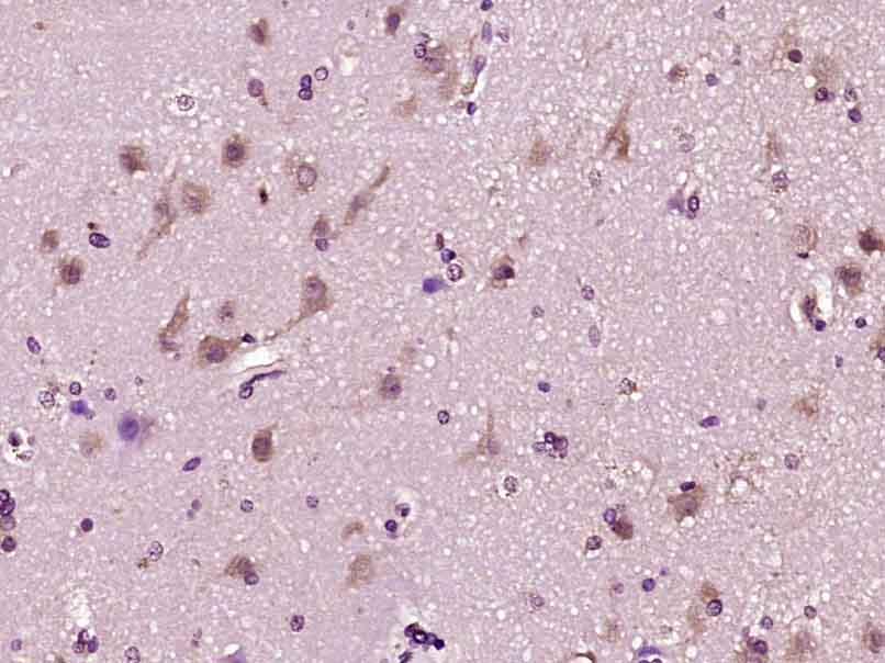 Rabbit anti-VEGF-C Polyclonal Antibody