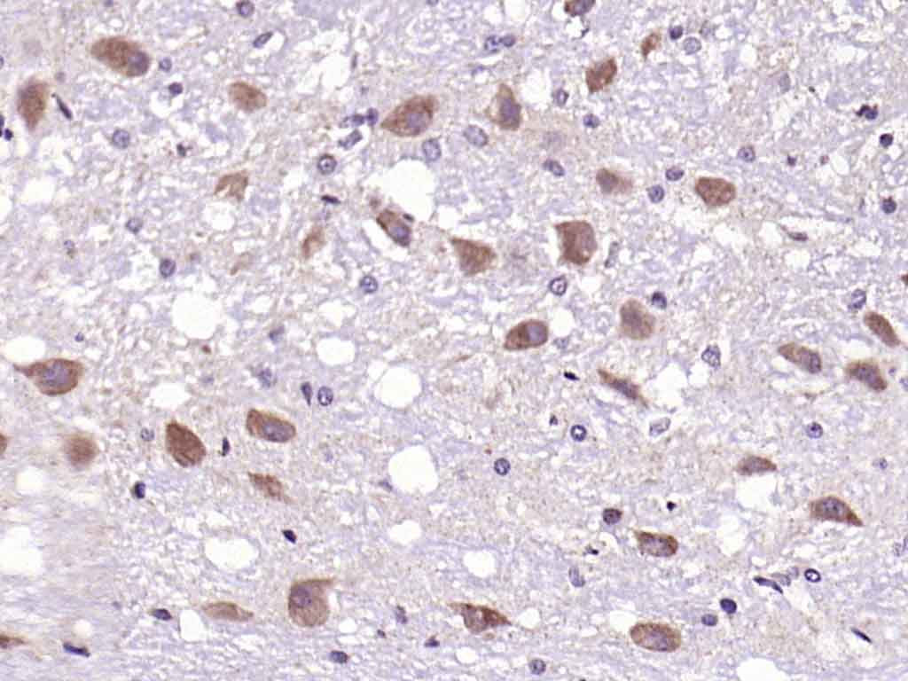 Rabbit anti-Phospho-PKC δ(Ser645) Polyclonal Antibody