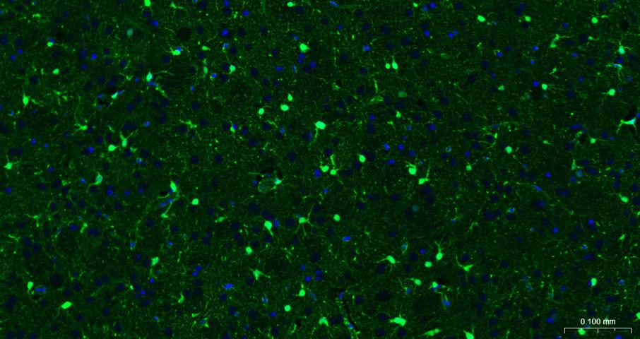 Mouse anti-S100B Monoclonal Antibody