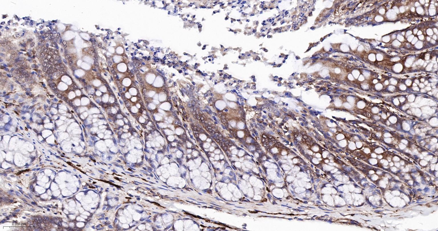 Rabbit anti-NFKB p65 Monoclonal Antibody