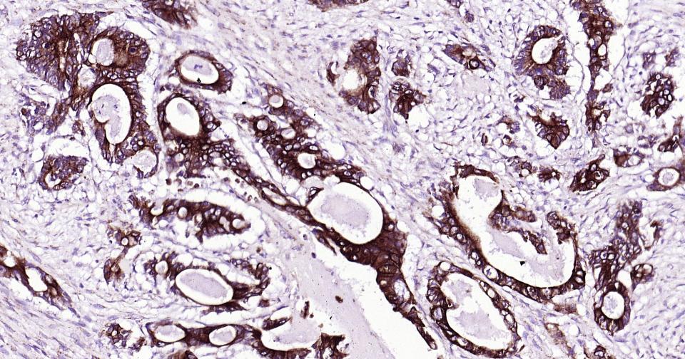 Mouse anti-Cytokeratin 19 Monoclonal Antibody