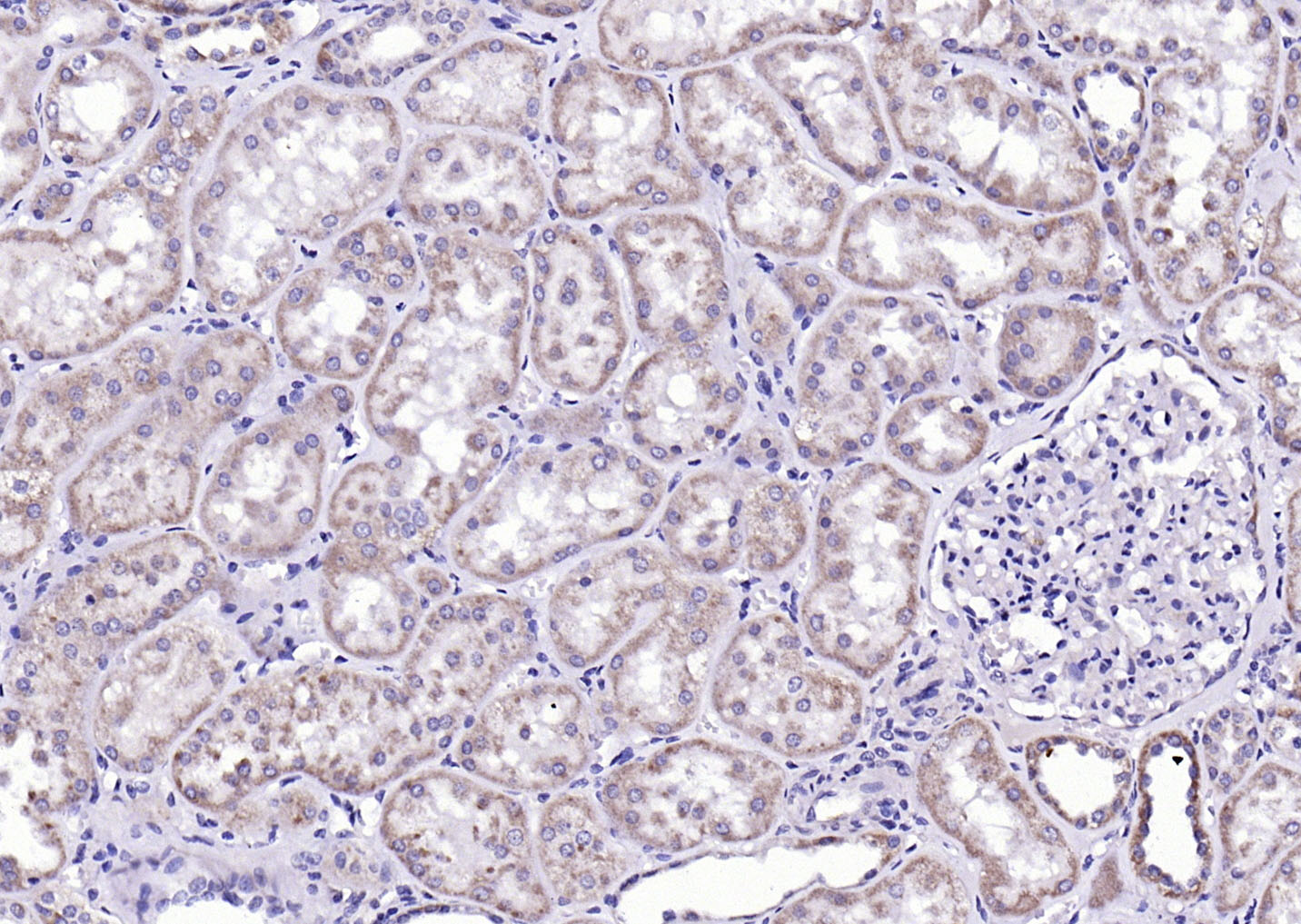 Rabbit anti-Phospho-CaMK2α(Tyr230) Polyclonal Antibody