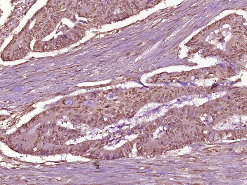 Rabbit anti-Phospho-NFKB p65(Thr254) Polyclonal Antibody