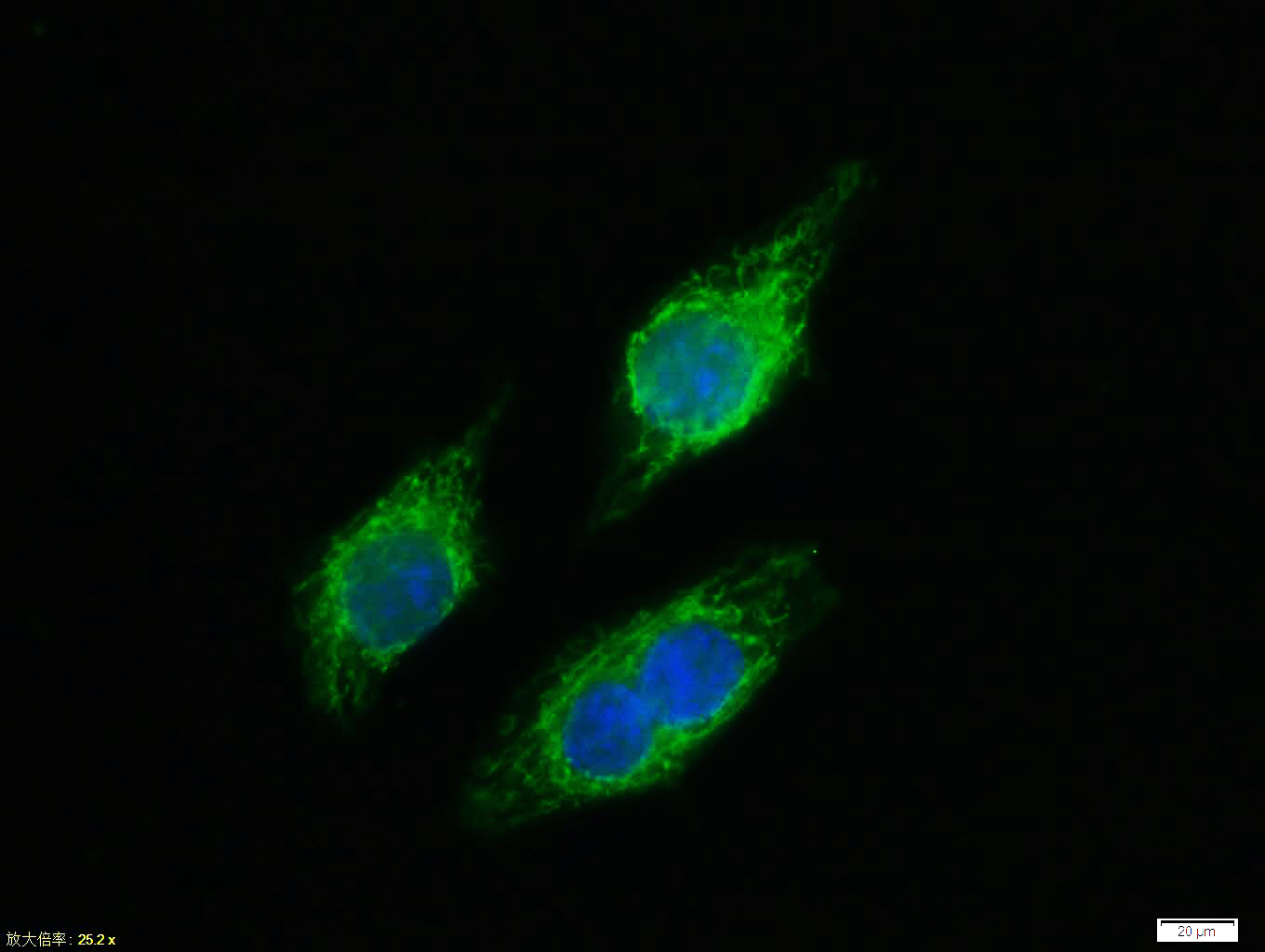 Rabbit anti-Phospho-NFKB p65(Thr435) Polyclonal Antibody