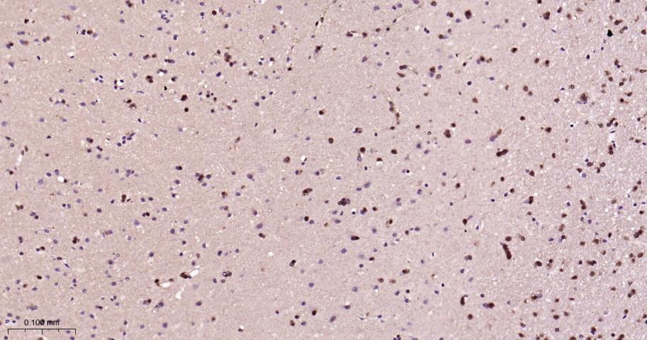 Rabbit anti-HSP70 Monoclonal Antibody