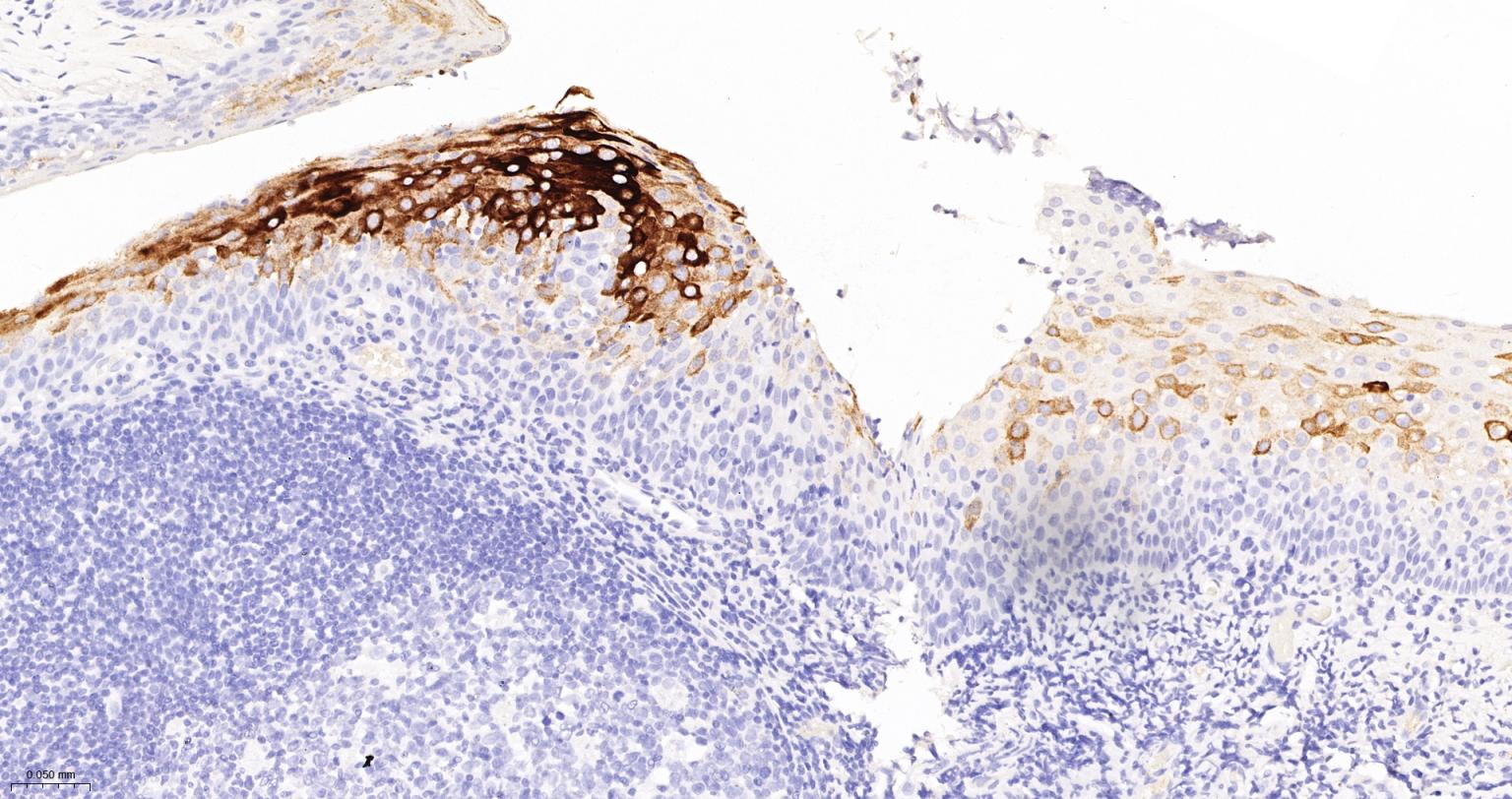 Rabbit anti-CK10/Cytokeratin 10 Monoclonal Antibody
