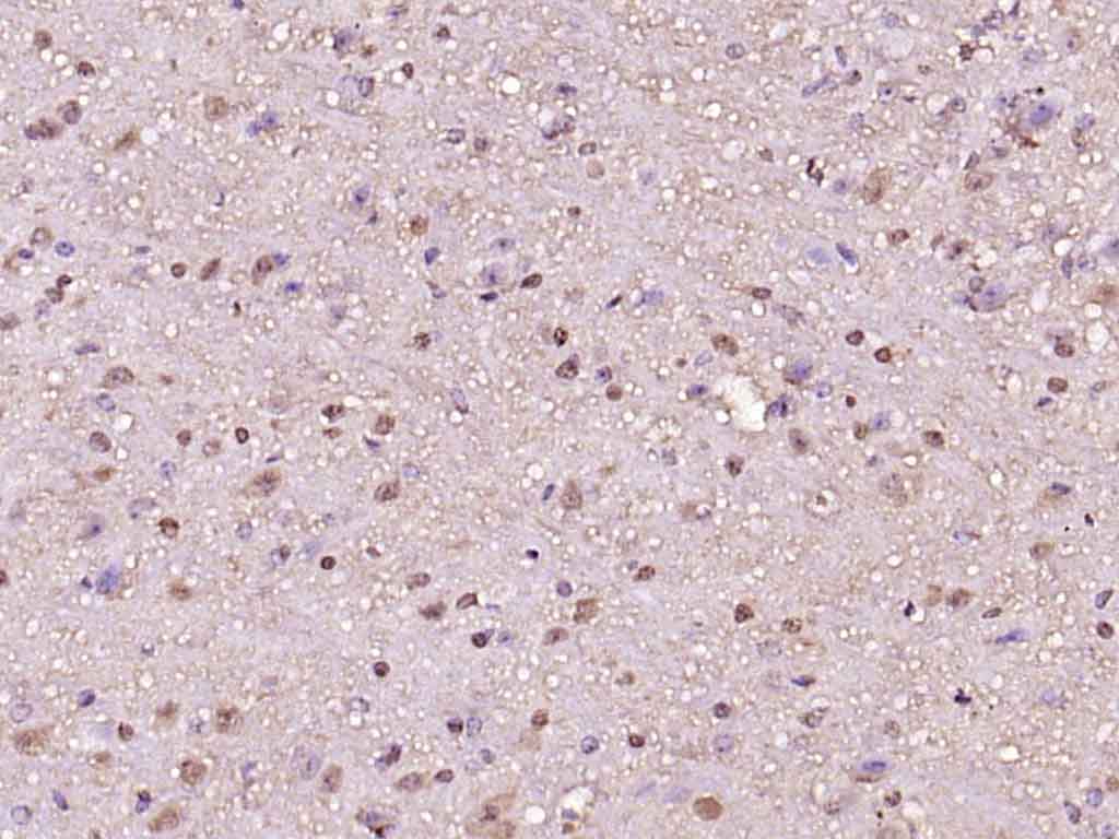 Rabbit anti-Phospho-Histone H1.4(Thr18) Polyclonal Antibody