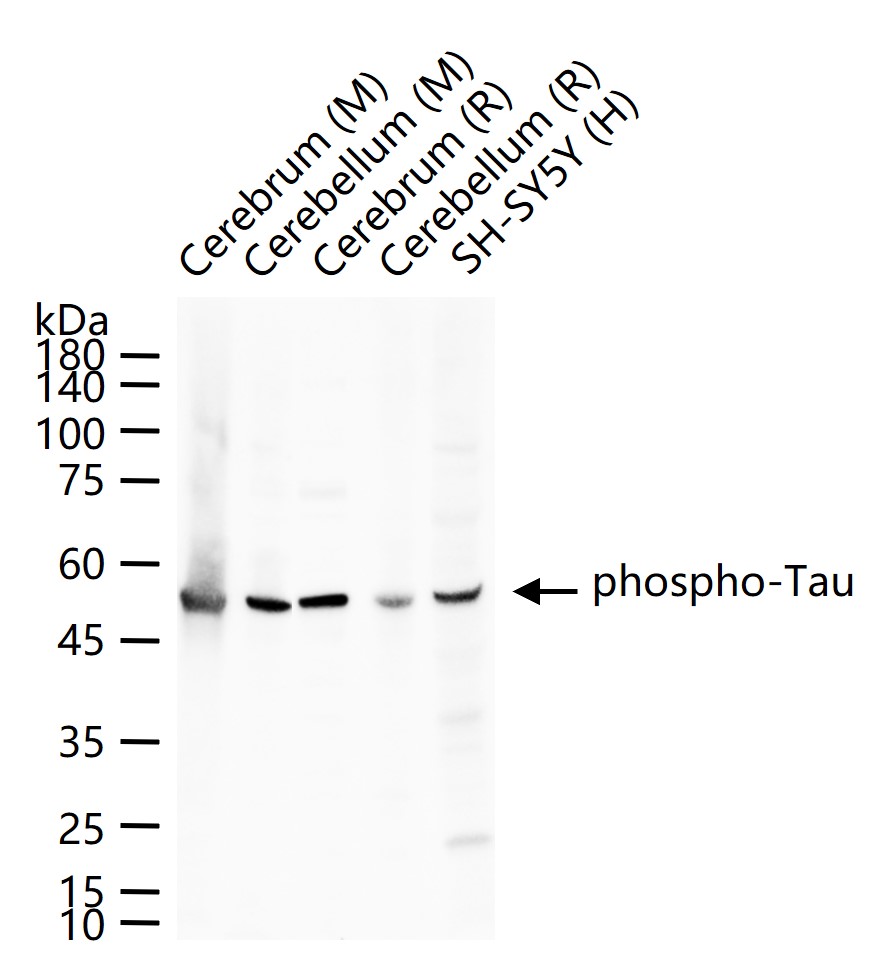 Rabbit anti-Phospho-Tau(Thr181) Polyclonal Antibody