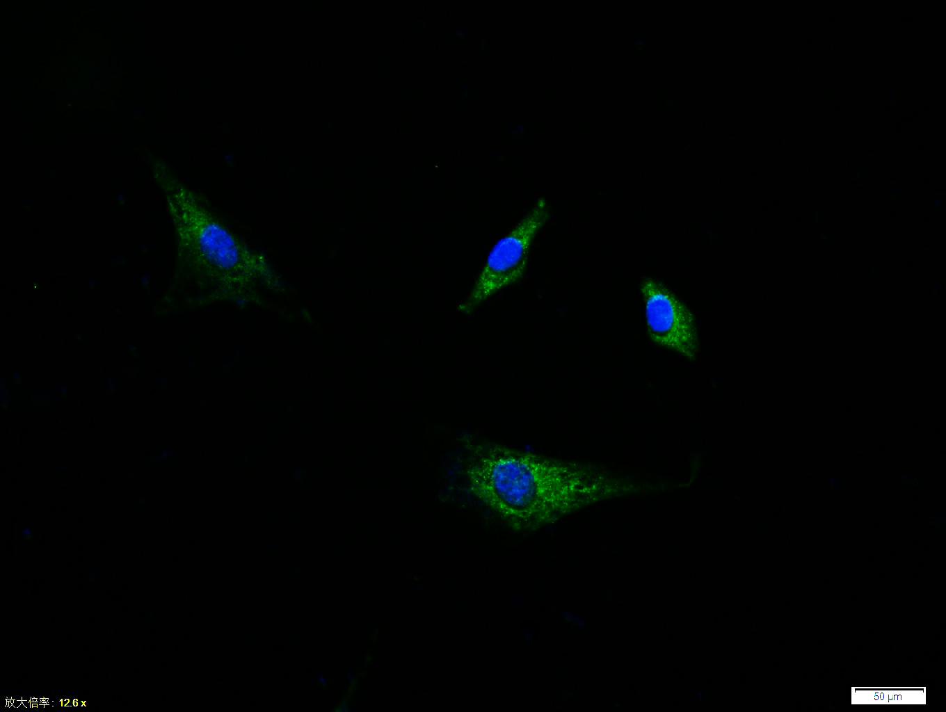 Rabbit anti-Phospho-PDGFRA(Tyr754) Polyclonal Antibody