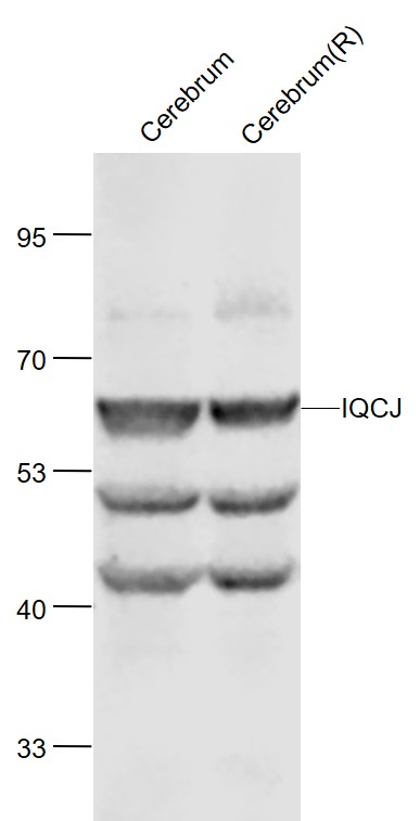 Rabbit anti-IQCJ Polyclonal Antibody
