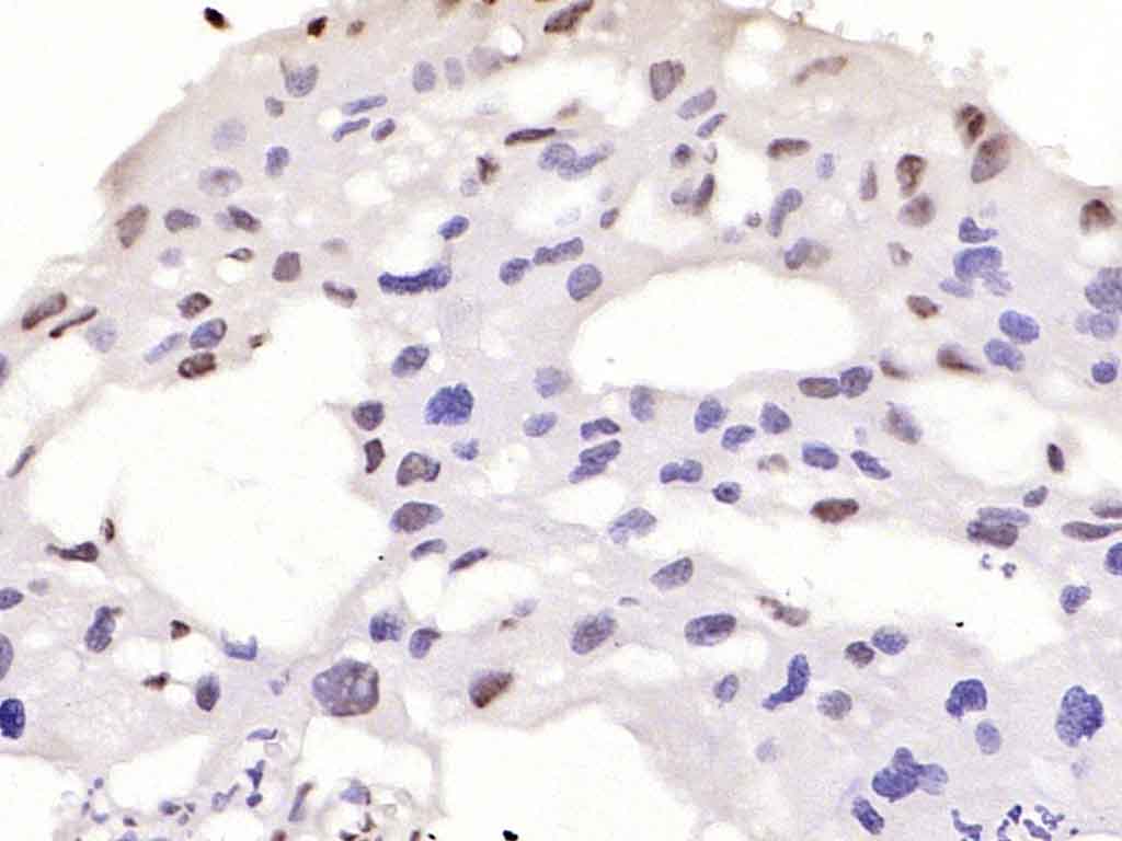 Rabbit anti-Phospho-Smad2(Ser467) Polyclonal Antibody