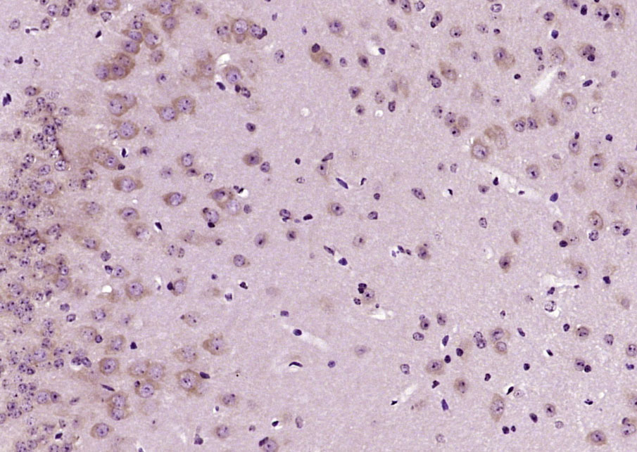 Rabbit anti-SOD2 Polyclonal Antibody