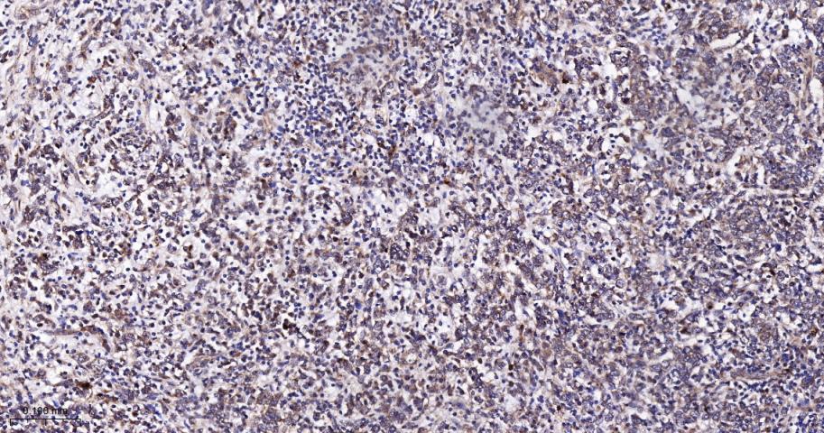 Rabbit anti-TSG101 Monoclonal Antibody