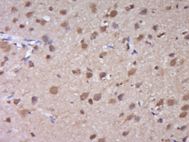 Rabbit anti-SUMO 1 Polyclonal Antibody