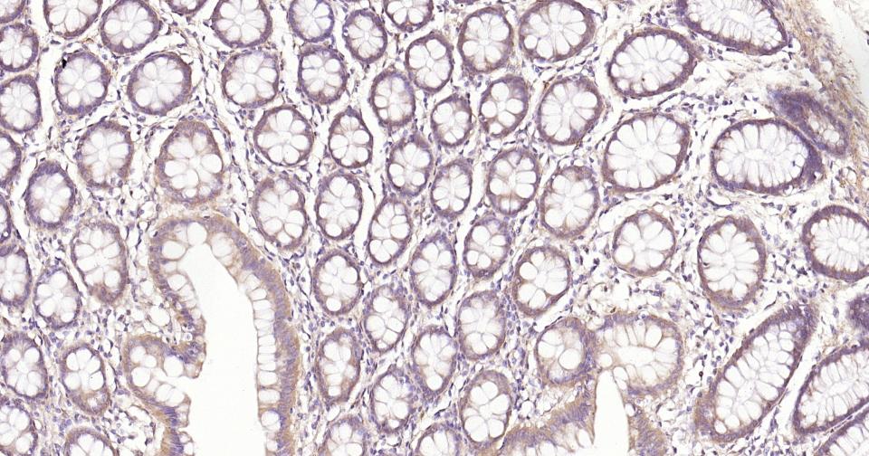 Rabbit anti-NFKB p65 Monoclonal Antibody