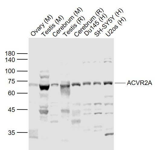 Rabbit anti-ACVR2A Polyclonal Antibody