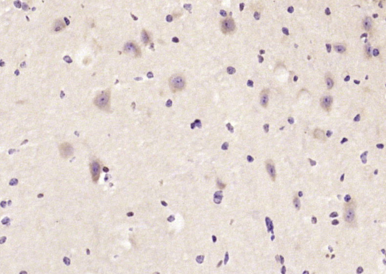 Rabbit Anti-TACC1 Polyclonal Antibody