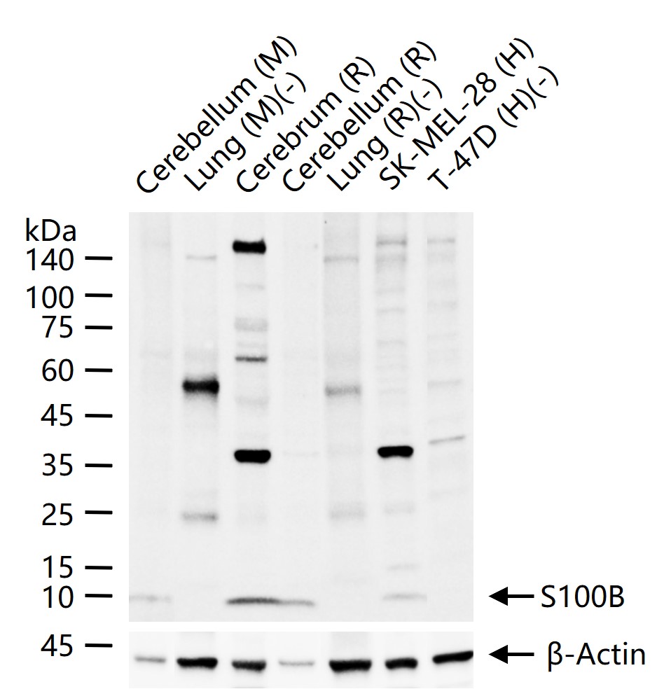 Mouse anti-S100B Monoclonal Antibody