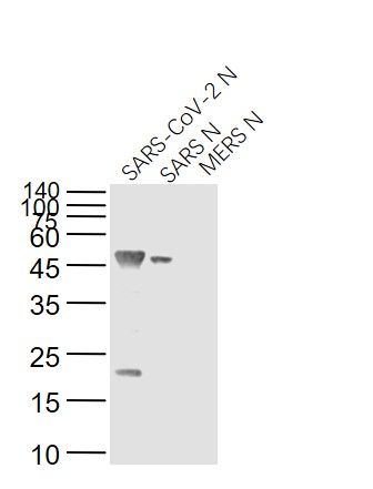 Mouse anti-SARS-CoV Nucleocapsid Monoclonal Antibody