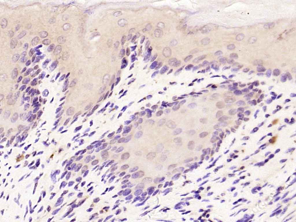 Rabbit anti-MADH7 Polyclonal Antibody