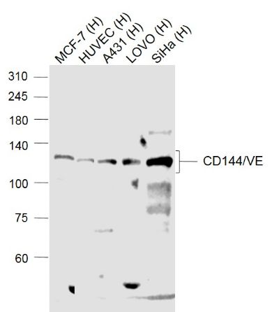 Rabbit anti-VE Cadherin Polyclonal Antibody