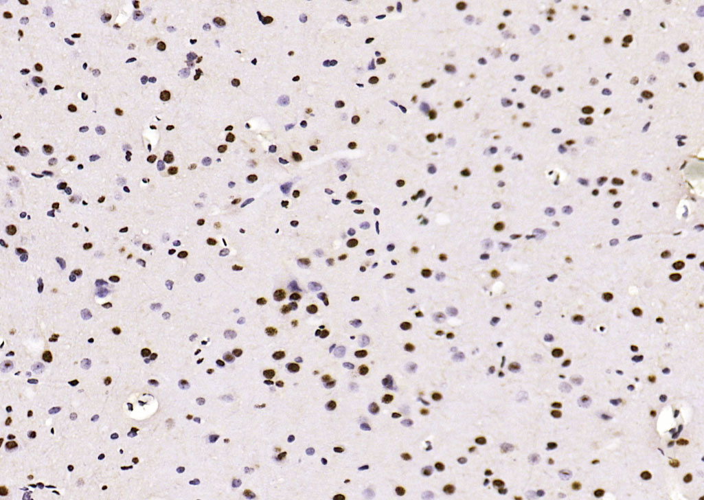 Rabbit anti-Phospho-PTEN(Ser380+Thr382+Thr383) Polyclonal Antibody