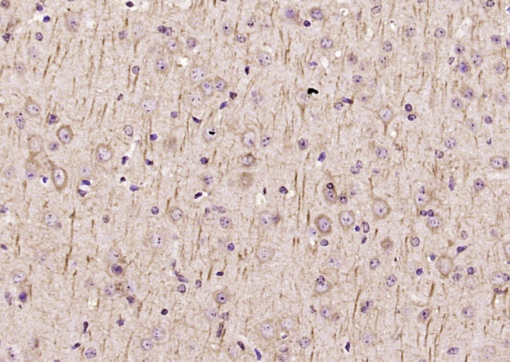Rabbit Anti-TRIM32/BBS11 Polyclonal Antibody