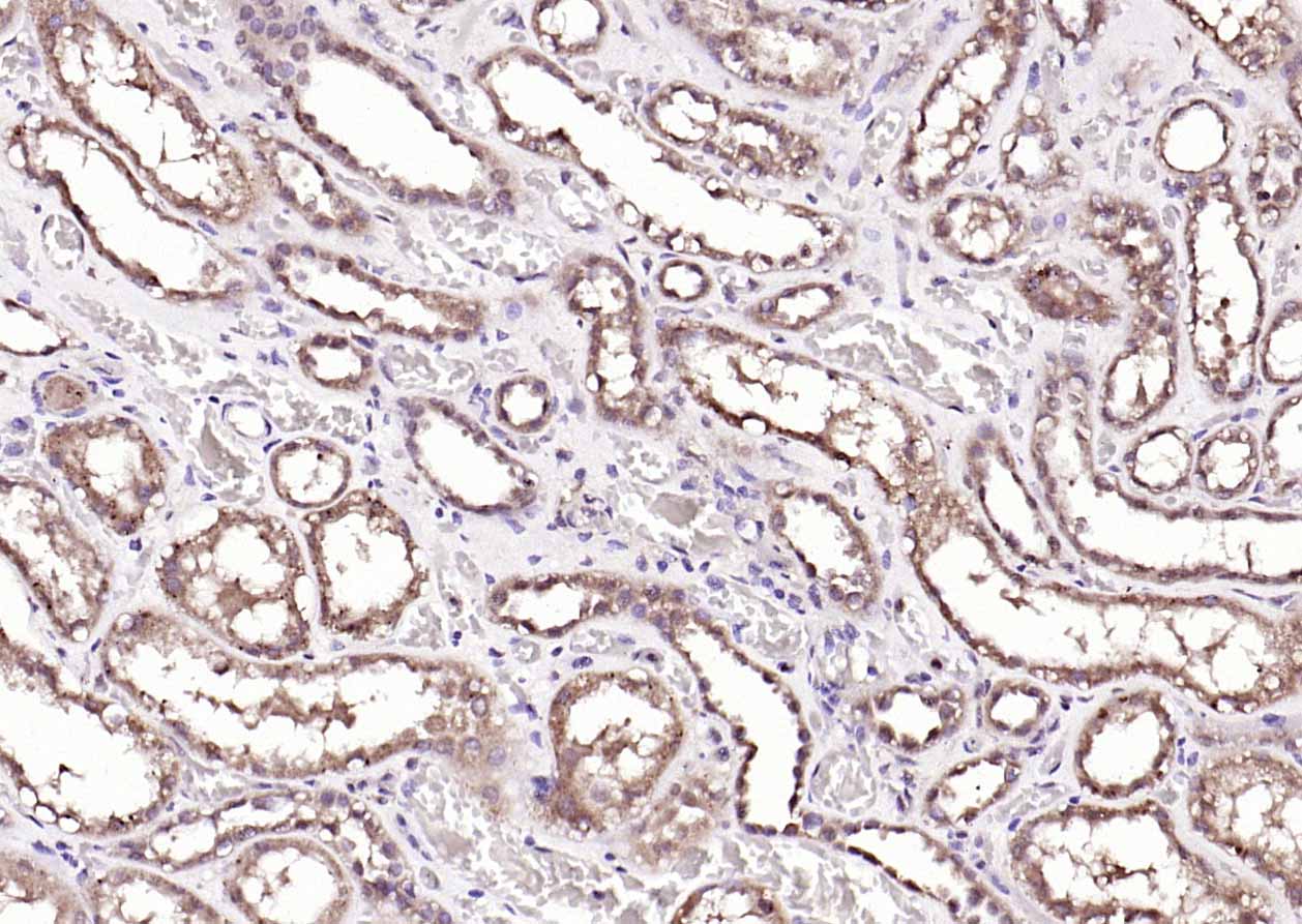 Rabbit anti-ANKRD54 Polyclonal Antibody