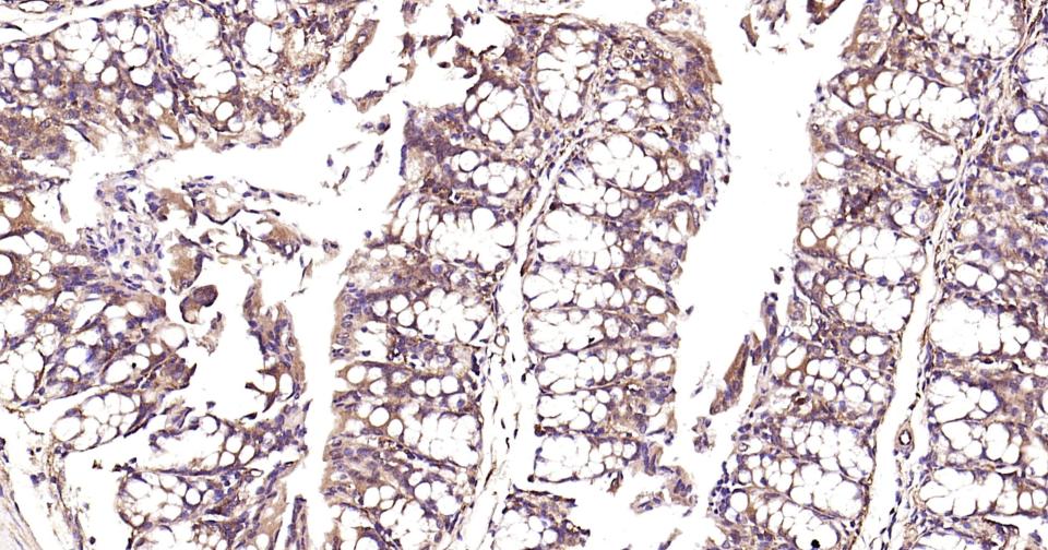 Rabbit anti-NFKB p65 Monoclonal Antibody