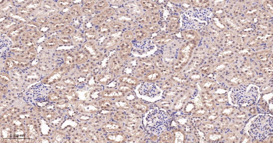 Rabbit anti-TSG101 Monoclonal Antibody
