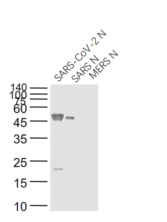Mouse anti-SARS-CoV Nucleocapsid Monoclonal Antibody