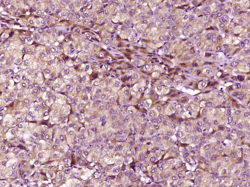 Rabbit anti-Phospho-IKKγ(Ser31) Polyclonal Antibody