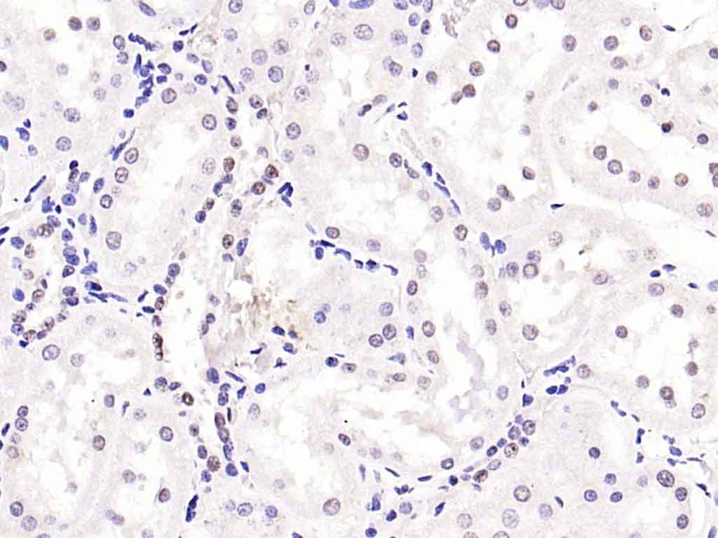 Rabbit anti-Phospho-Smad2(Ser467) Polyclonal Antibody