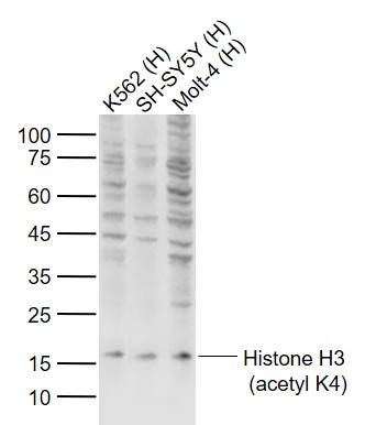 Rabbit anti-Histone H3(acetyl K4) Polyclonal Antibody