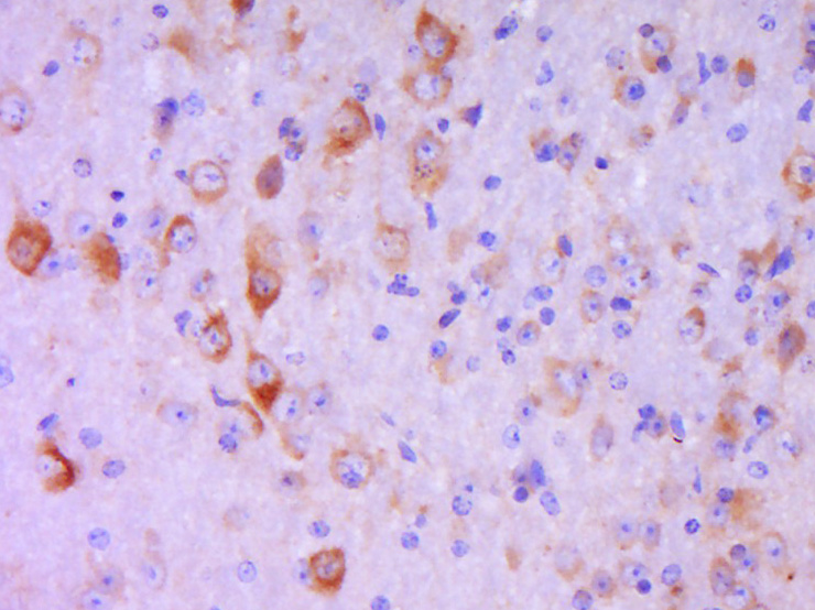 Rabbit anti-Phospho-FAK(Tyr407) Polyclonal Antibody