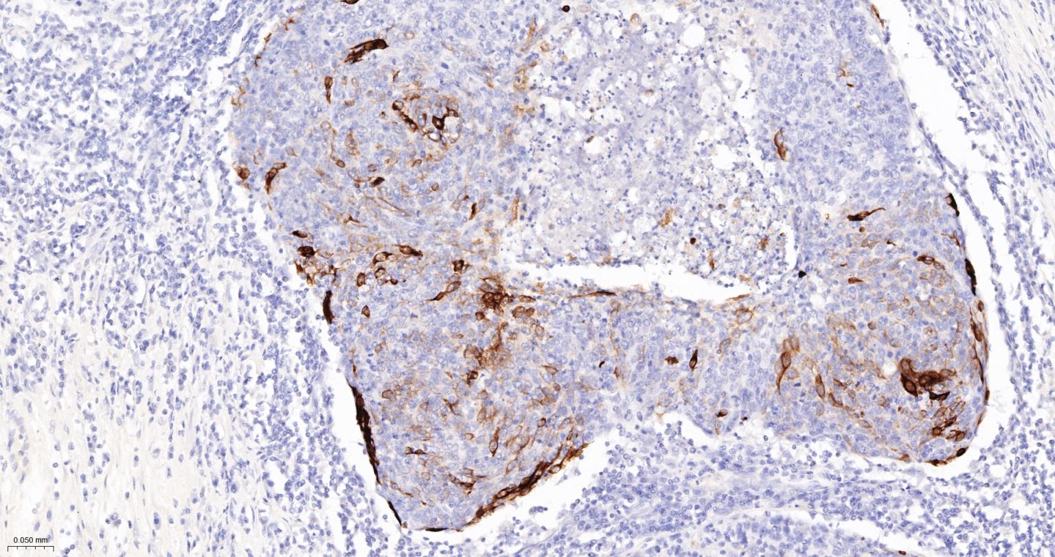 Rabbit anti-CK10/Cytokeratin 10 Monoclonal Antibody