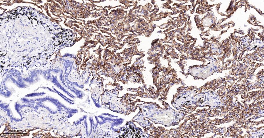 Rabbit anti-RAGE Monoclonal Antibody