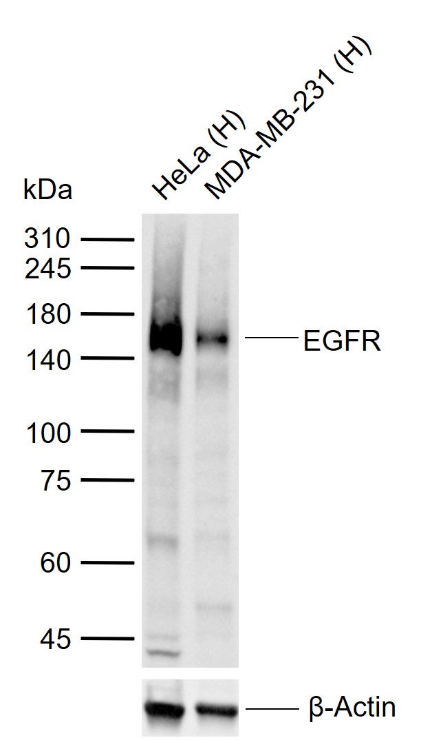 Rabbit anti-EGFR Polyclonal Antibody