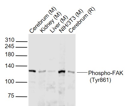 Rabbit anti-Phospho-FAK(Tyr861) Polyclonal Antibody