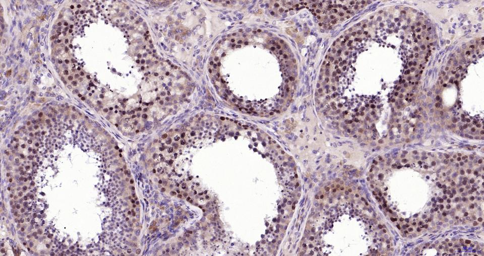 Rabbit anti-Phospho-Nrf2(Ser40) Monoclonal Antibody
