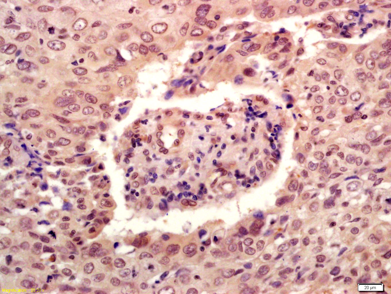 Rabbit anti-Phospho-P53(Ser46) Polyclonal Antibody