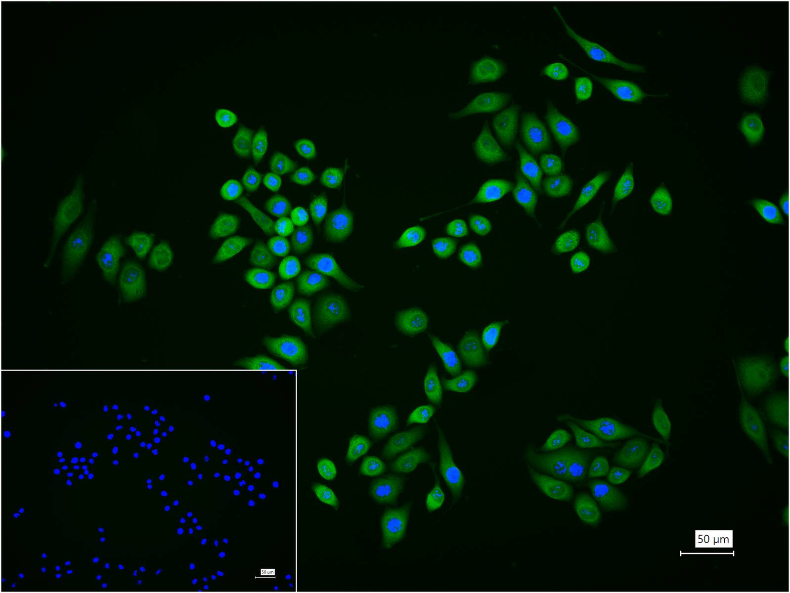 Rabbit anti-HSP70 Monoclonal Antibody