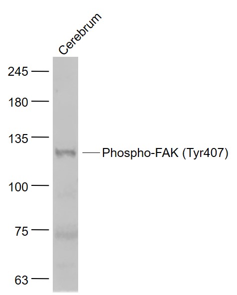Rabbit anti-Phospho-FAK(Tyr407) Polyclonal Antibody