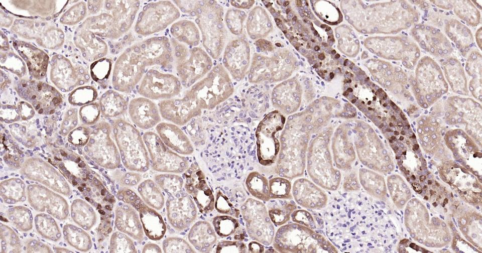 Rabbit anti-Galectin 3 Polyclonal Antibody