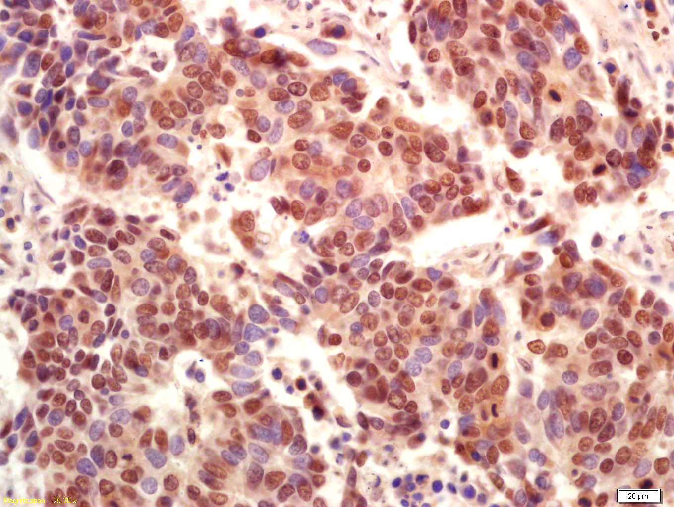 Rabbit anti-Phospho-PI3 Kinase p110 β(Ser1070) Polyclonal Antibody
