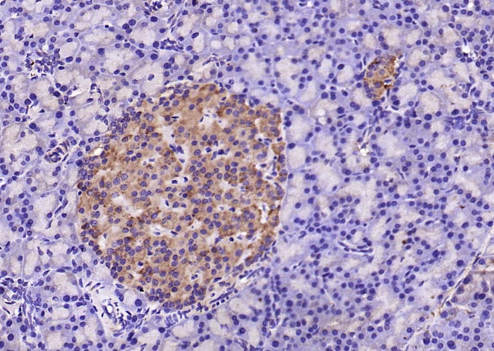Rabbit anti-SOD2 Polyclonal Antibody