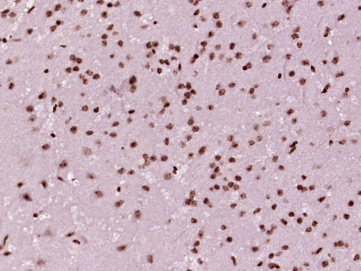 Rabbit anti-Phospho-TH(Ser31) Polyclonal Antibody