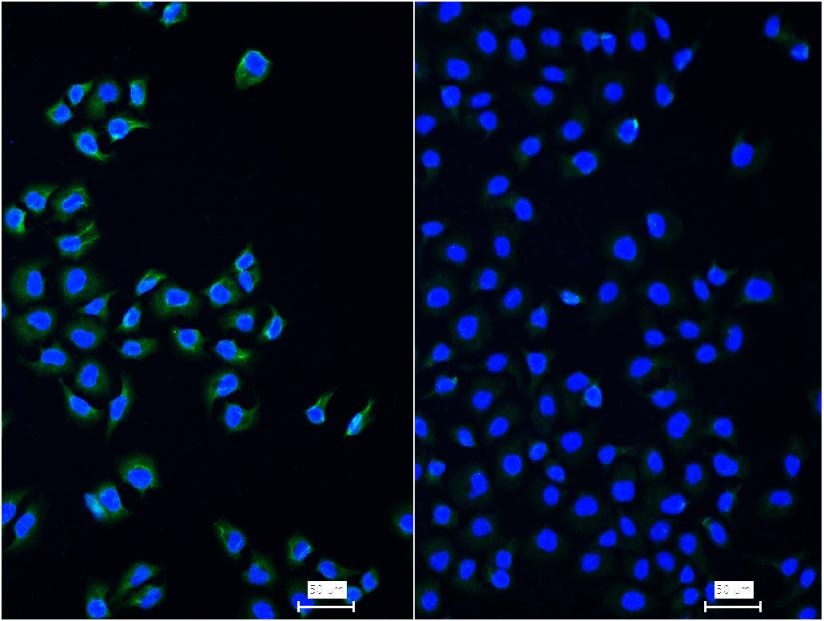 Rabbit anti-NFKB p65 Monoclonal Antibody
